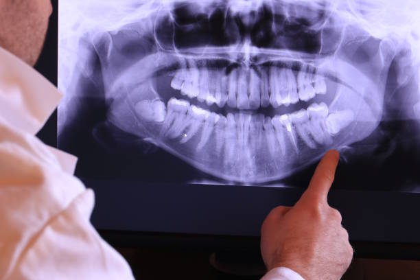 Best Emergency Denture Repair in Republic, WA